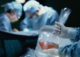 جراحة نقل أعضاء